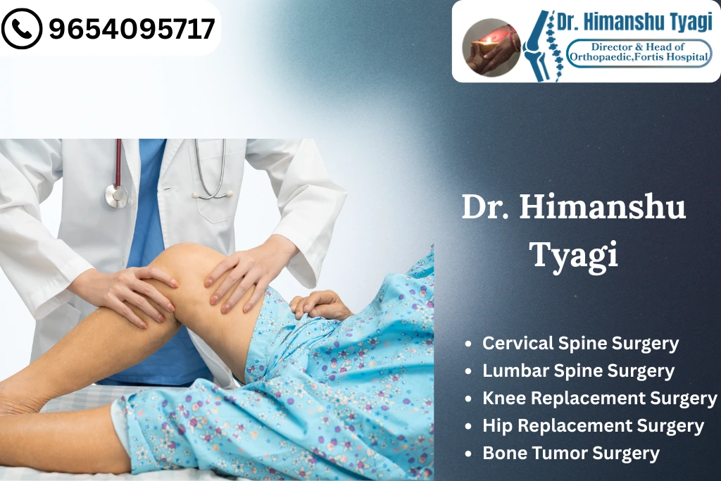 Best Knee Replacement Surgeon in Noida: Restore Your Mobility with Expert Care
