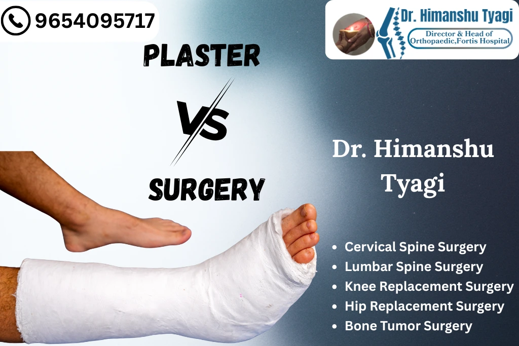 Plaster Vs Surgery: Here’s How Your Fracture Treatment is Decided by Sports Injury Clinic In Noida